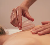 cupping therapy in NE Calgary